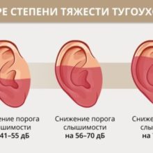 Все о тугоухости